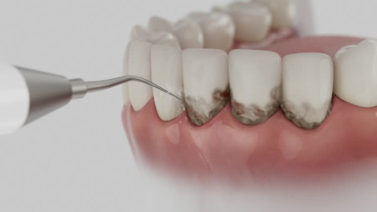 Trusted Tooth Extraction service in Brentwood, MD - Dentist Open Now